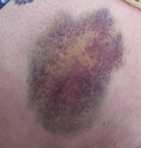 2012-12-24 479 (474x500)