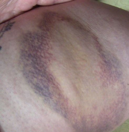 2012-12-24 503 (491x500)