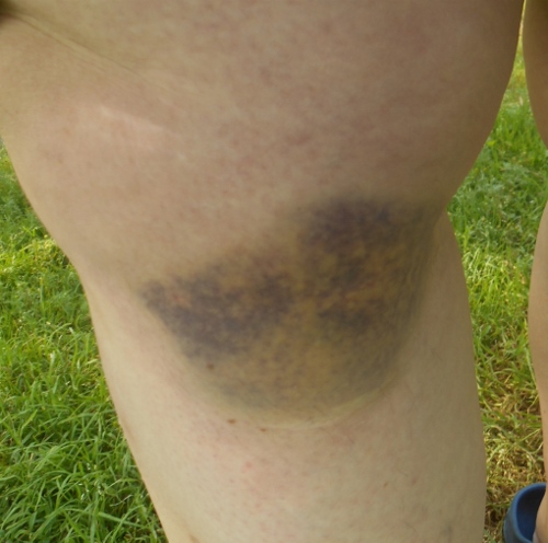 2013-01-01 2466 (500x496)